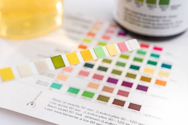 Are there any tests I can do to see if I am in ketosis?